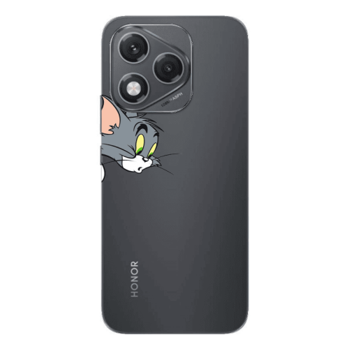 Honor 400 Lite Tom 1 Transparent Silicone TPU Θήκη